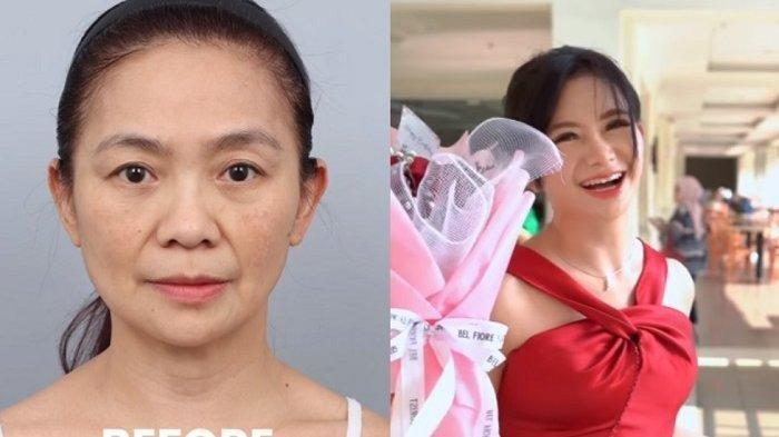 Viral! Dibilang Awet Muda, Puspa Dewi Justru Operasi Wajah di Usia 56 Tahun